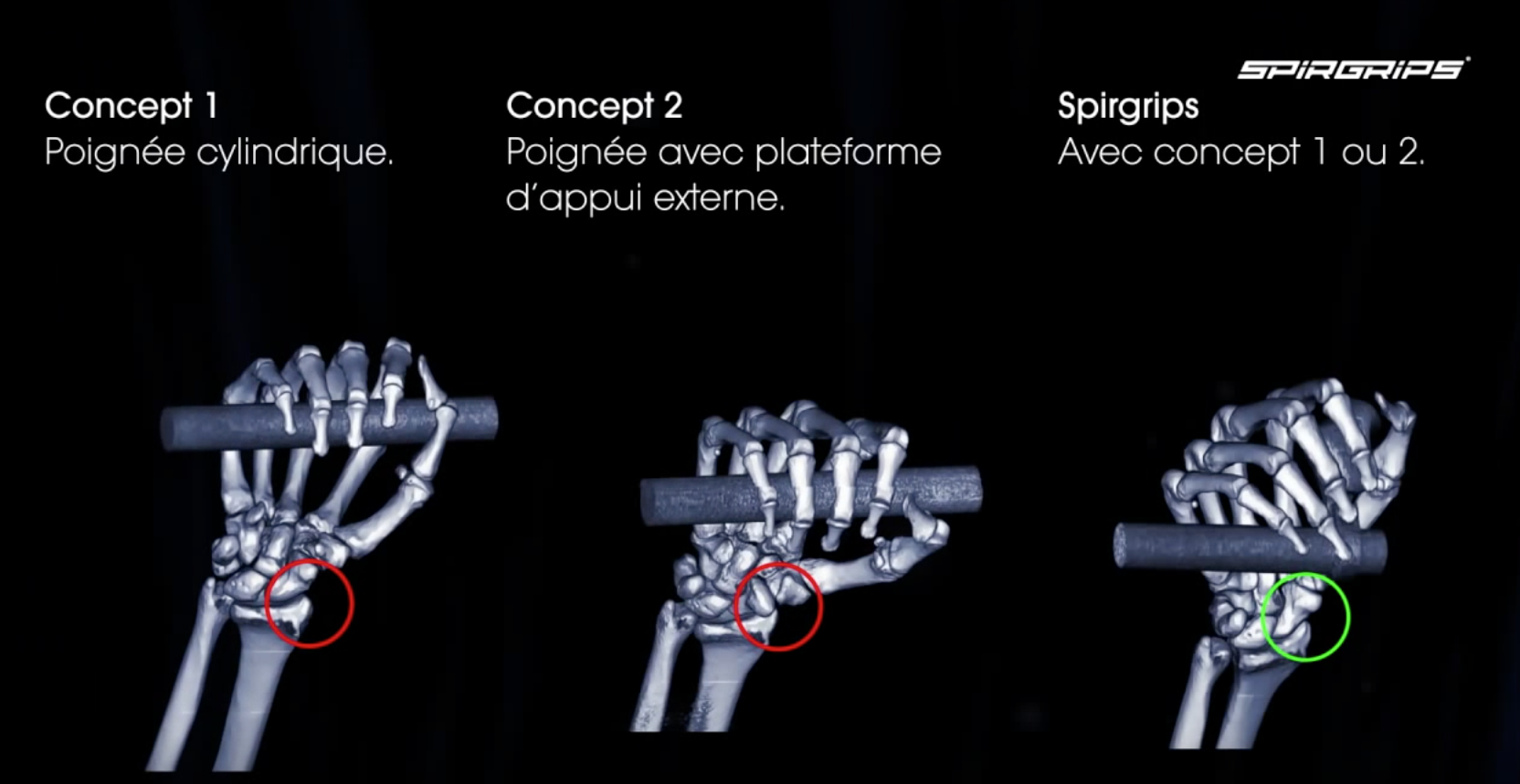 Poignées Ergonomiques VTT Spirgrips - Noires